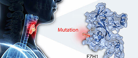 Eine Mutation in dem EZH1-Gen ist der zweithäufigste genetische Defekt in autonomen Adenomen. Dies haben Wissenschaftler der Uni Würzburg jetzt gezeigt. (Abbildung: Davice Calebiro / Kerstin Bathon)