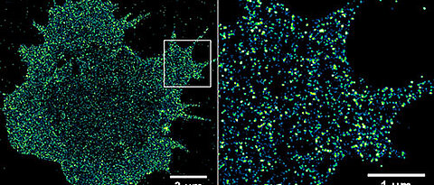 Immunrezeptoren auf einer Krebszelle. Mit Hilfe der hochauflösenden Fluoreszenzmikroskopie ist es möglich, Rezeptoren in der Zellmembran mit Einzelmolekül-Sensitivität zu visualisieren und zu quantifizieren. (Bild: Sebastian Letschert)