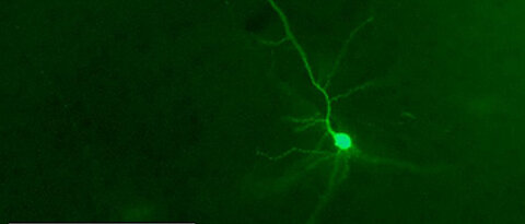 Im Vergleich zu Masernvirus-infizierten Hirnen normaler Mäuse (A), in denen nach 28 Tagen nur wenige Neurone infiziert sind (grün fluoreszierend), sind aufgrund der eingeschränkten Immunantwort in ASM-defizienten Mäusen wesentlich mehr Neurone infizie