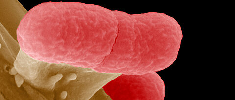 Elektronenmikroskopische Aufnahme von Escheria colis auf einer Darmzelle. Diese Darmbakterien waren eine der untersuchten Arten in der Studie.