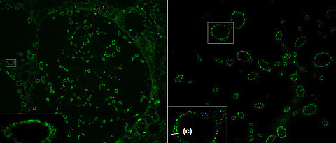 Sphingolipid-Expansionsmikroskopie (ExM) von zehnfach expandierten Zellen, die mit Chlamydien infiziert wurden. Grün markiert sind die Bakterienmembranen; die innere und die äußere Membran der Bakterien lassen sich unterscheiden (c). Unter (a) konfokales Laser-Scanning und unter (b) Strukturierte Beleuchtungsmikroskopie (SIM). Maßstabsbalken: 10 bzw. 2 Mikrometer in den kleinen weißen Rechtecken.