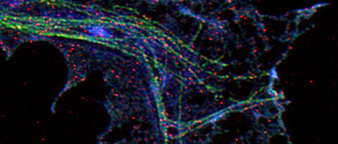 Hochauflösende Mikroskopie einer Axonterminale eines kultivierten Motoneurons: Mikrotubuli sind mit grünem Fluoreszenzfabstoff gefärbt, Stathmin in blau,  Stat-3 in rot. (Abbildung: Preeti Yadav, Michael Sendtner, Markus Sauer, Universität Würzburg).