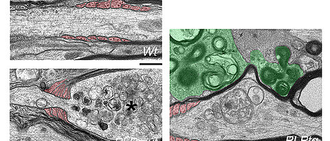 Elektronenmikroskopische Aufnahmen von Axonen in der weißen Substanz von gesunden Kontroll-Mäusen (links oben) und von Mäusen mit verschiedenen Myelin-Gendefekten. Axone, die mit abnormem Myelin umwickelt bleiben (links unten), werden von Fortsätzen der Oligodendrozyten (rot gefärbt) eingeschnürt und weisen Merkmale der Degeneration auf (Stern). Im Gegensatz dazu haben Axone, deren Myelin durch Mikroglia (grün gefärbt, rechtes Bild) entfernt wird, eine höhere Chance zu überleben. Größenmaßstab: 0,5 µm. 