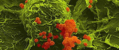 Meningokokken (orange) haben sich an menschliche Wirtszellen (grün) angeheftet. Rasterelektronenmikroskopische Aufnahme in Falschfarbendarstellung.