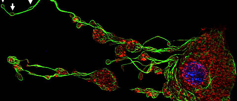 Mikroskopische Aufnahme einer Zelle, von der sich junge Blutplättchen abschnüren. (Bild: Rudolf-Virchow-Zentrum)