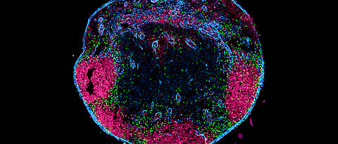 Querschnitt durch einen Lymphknoten. Die unkonventionellen T-Zellen (grün), die über die Lymphbahnen aus dem Gewebe eingewandert sind, befinden sich im Randsinus und in der interfollikulären Zone. Follikuläre B-Zellen sind magenta dargestellt, die Lymphknotenkapsel und lymphatischen Gefäße in blau.