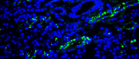 Fluoreszenzaufnahme aus der Nierenbiopsie der DRESS-Patientin