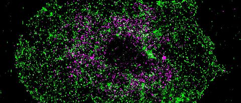Aufklärung der Kolokalisierung von BIN2 (grün) und STIM1 (magenta) mit Hilfe von superhochauflösender Fluoreszenzmikroskopie (dSTORM) im aktivierten Blutplättchen.